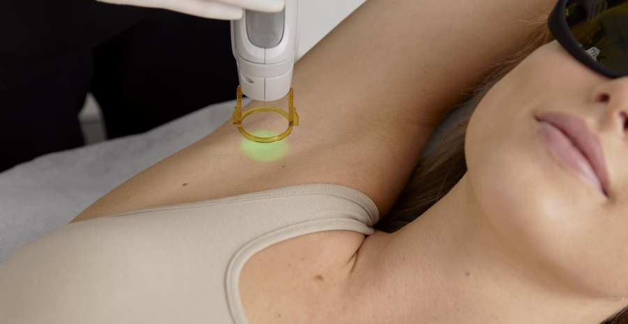 Laser Hair Removal for Armpits / Underarms: Expectations, Benefits, Costs, & More